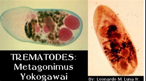  Metagonimus yokogawai:  A Tiny Trematode That Thrives in Silence and Sneaks Onto Your Plate!