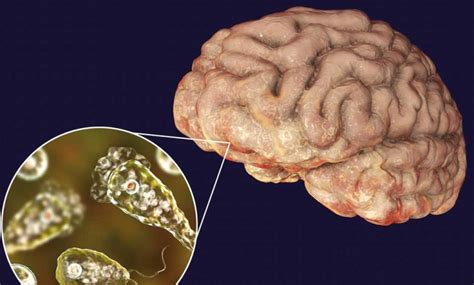  Naegleria - 뇌를 먹는 애메바! 정말 무서운 조상이 있었나요?